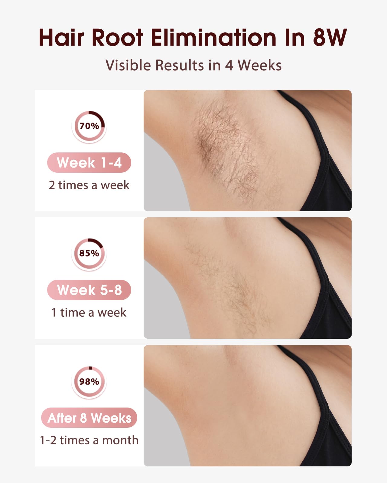 LYSMOSKI Laser Hair Removal, IPL Hair Removal with Ice-Cooling
